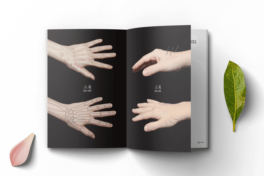 The Power of the Points – Part 2 Dr Tan's Balance Method Acupuncture